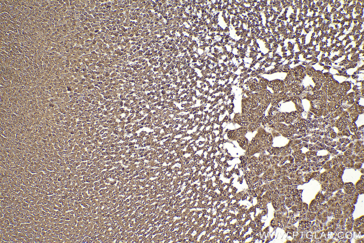 Immunohistochemical analysis of paraffin-embedded rat adrenal gland tissue slide using KHC2299 (FXR1 IHC Kit).