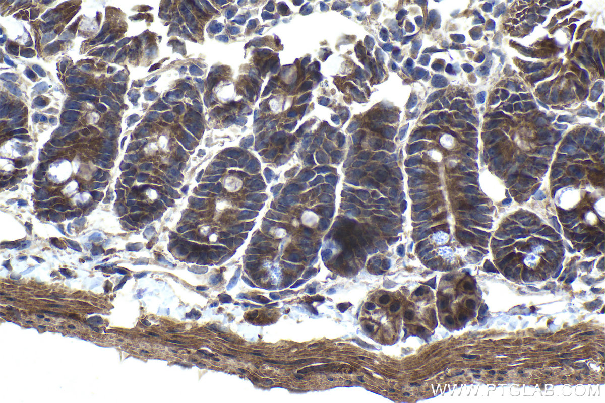 Immunohistochemical analysis of paraffin-embedded mouse small intestine tissue slide using KHC1067 (FZD7 IHC Kit).