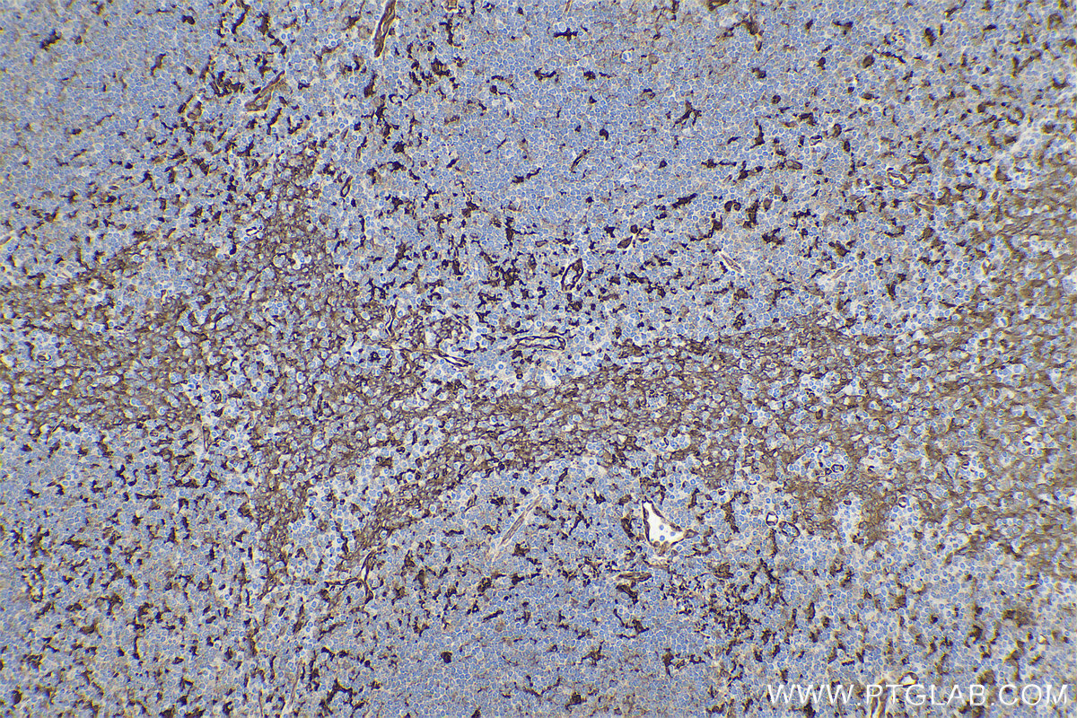 Immunohistochemical analysis of paraffin-embedded human tonsillitis tissue slide using KHC0772 (Fascin IHC Kit).