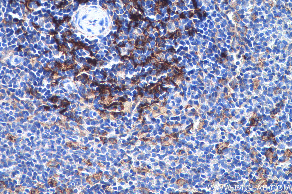 Immunohistochemical analysis of paraffin-embedded rat spleen tissue slide using KHC0772 (Fascin IHC Kit).