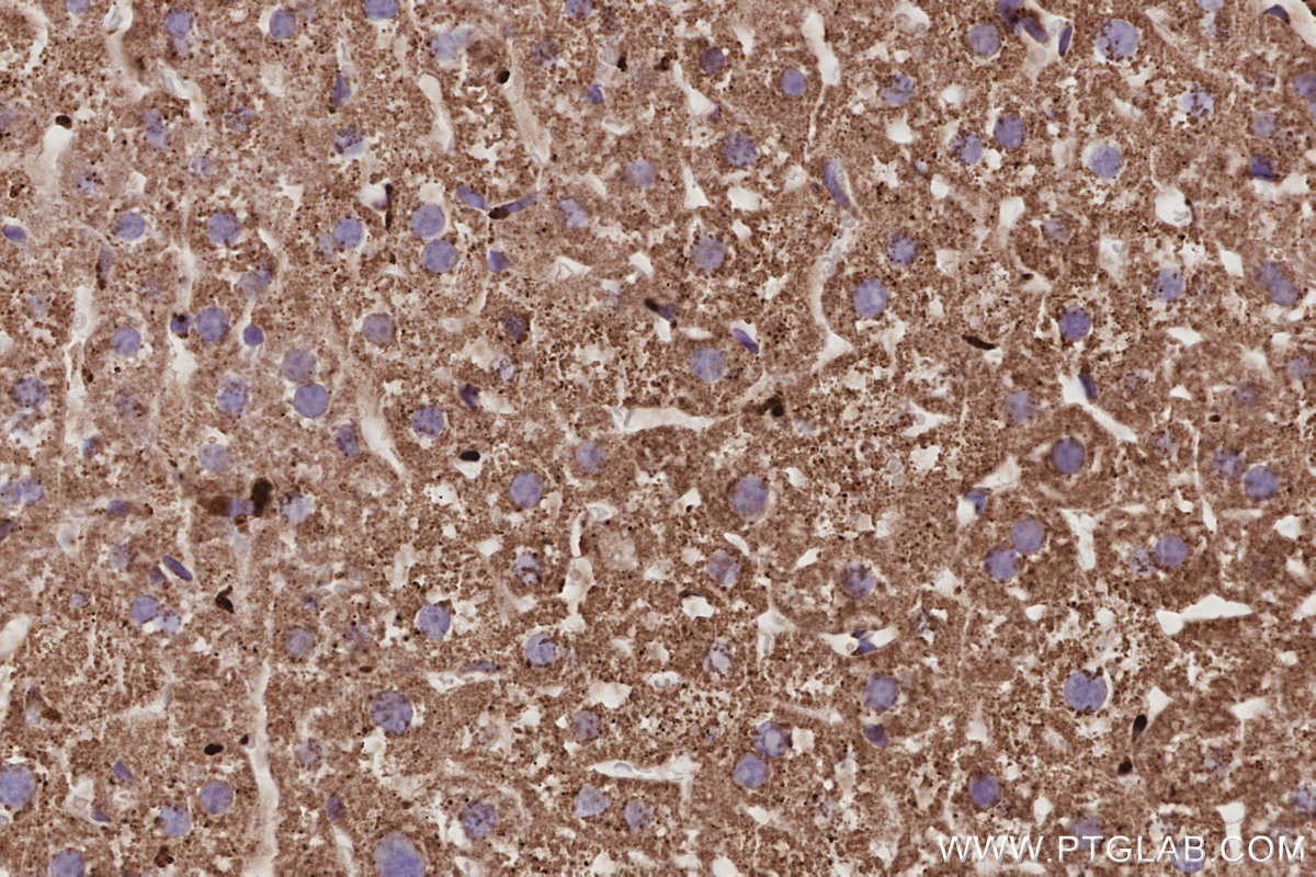 Immunohistochemical analysis of paraffin-embedded mouse liver tissue slide using KHC3025 (Fetuin-B IHC Kit). Immunohistochemical analysis of paraffin-embedded mouse liver tissue slide using KHC3025 (Fetuin-B IHC Kit).