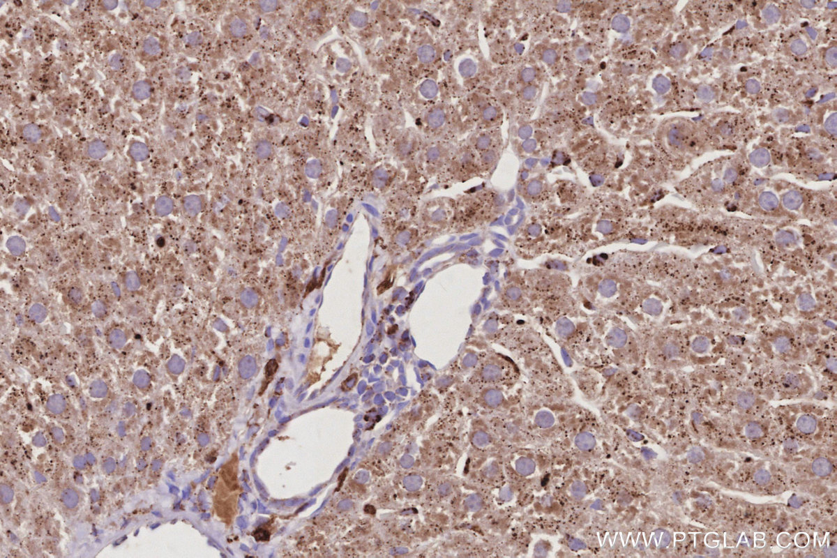 Immunohistochemical analysis of paraffin-embedded rat liver tissue slide using KHC3025 (Fetuin-B IHC Kit). Immunohistochemical analysis of paraffin-embedded rat liver tissue slide using KHC3025 (Fetuin-B IHC Kit).