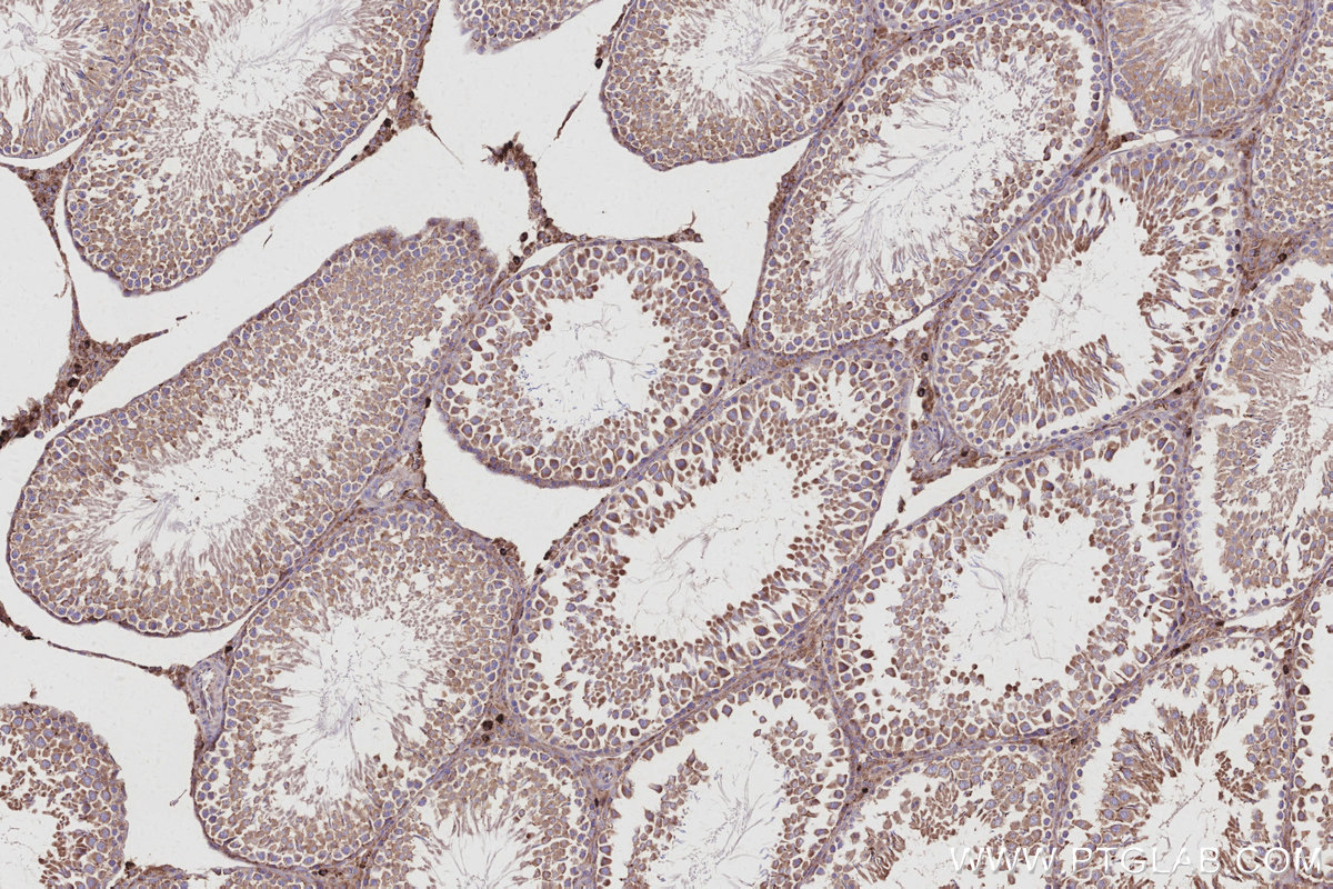Immunohistochemical analysis of paraffin-embedded rat testis tissue slide using KHC3025 (Fetuin-B IHC Kit). Immunohistochemical analysis of paraffin-embedded rat testis tissue slide using KHC3025 (Fetuin-B IHC Kit).