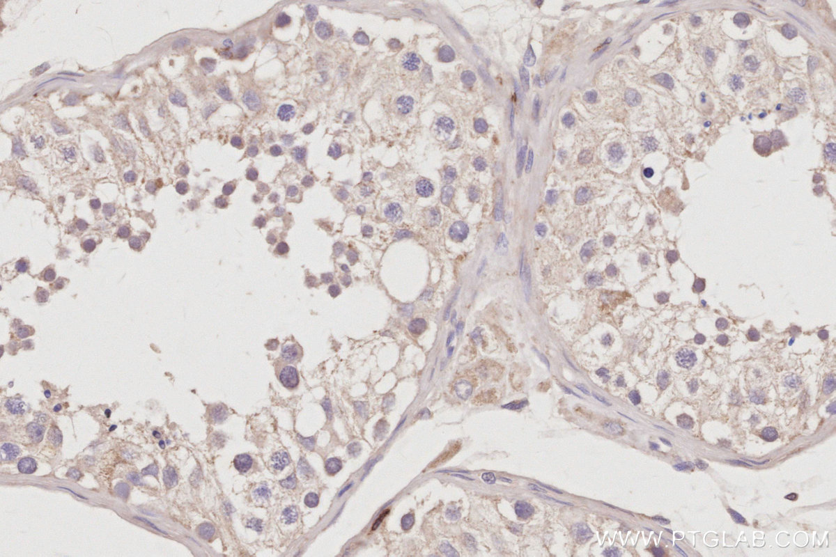 Immunohistochemical analysis of paraffin-embedded human testis tissue slide using KHC3025 (Fetuin-B IHC Kit). Immunohistochemical analysis of paraffin-embedded human testis tissue slide using KHC3025 (Fetuin-B IHC Kit).