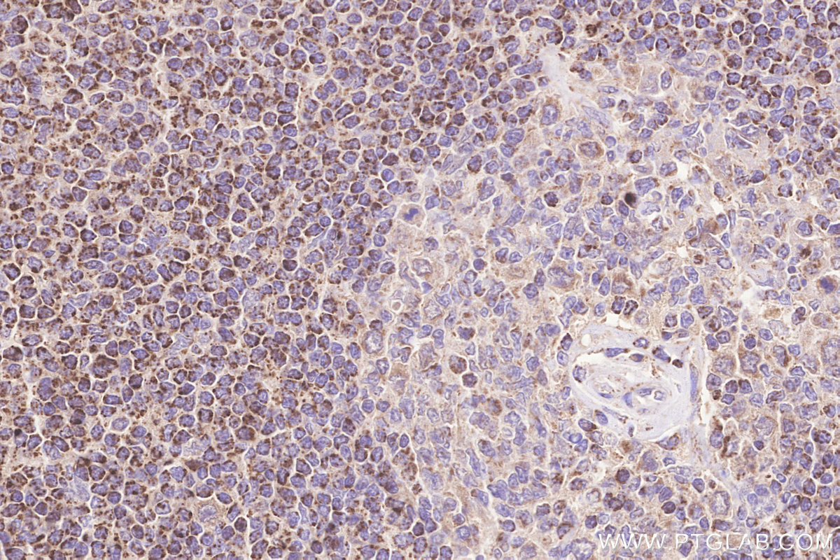 Immunohistochemical analysis of paraffin-embedded human spleen tissue slide using KHC3257 (Frataxin IHC Kit).