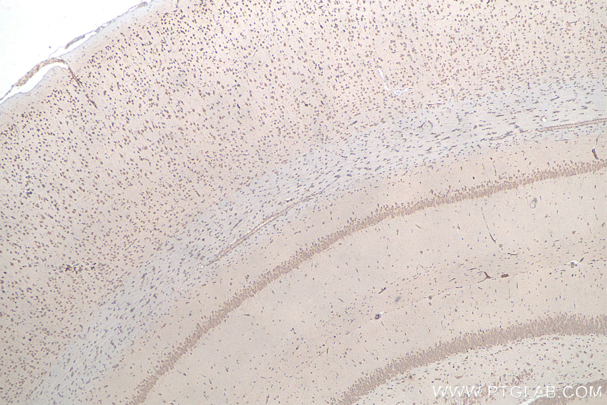 Immunohistochemical analysis of paraffin-embedded rat brain tissue slide using KHC0047 (G3BP1 IHC Kit).