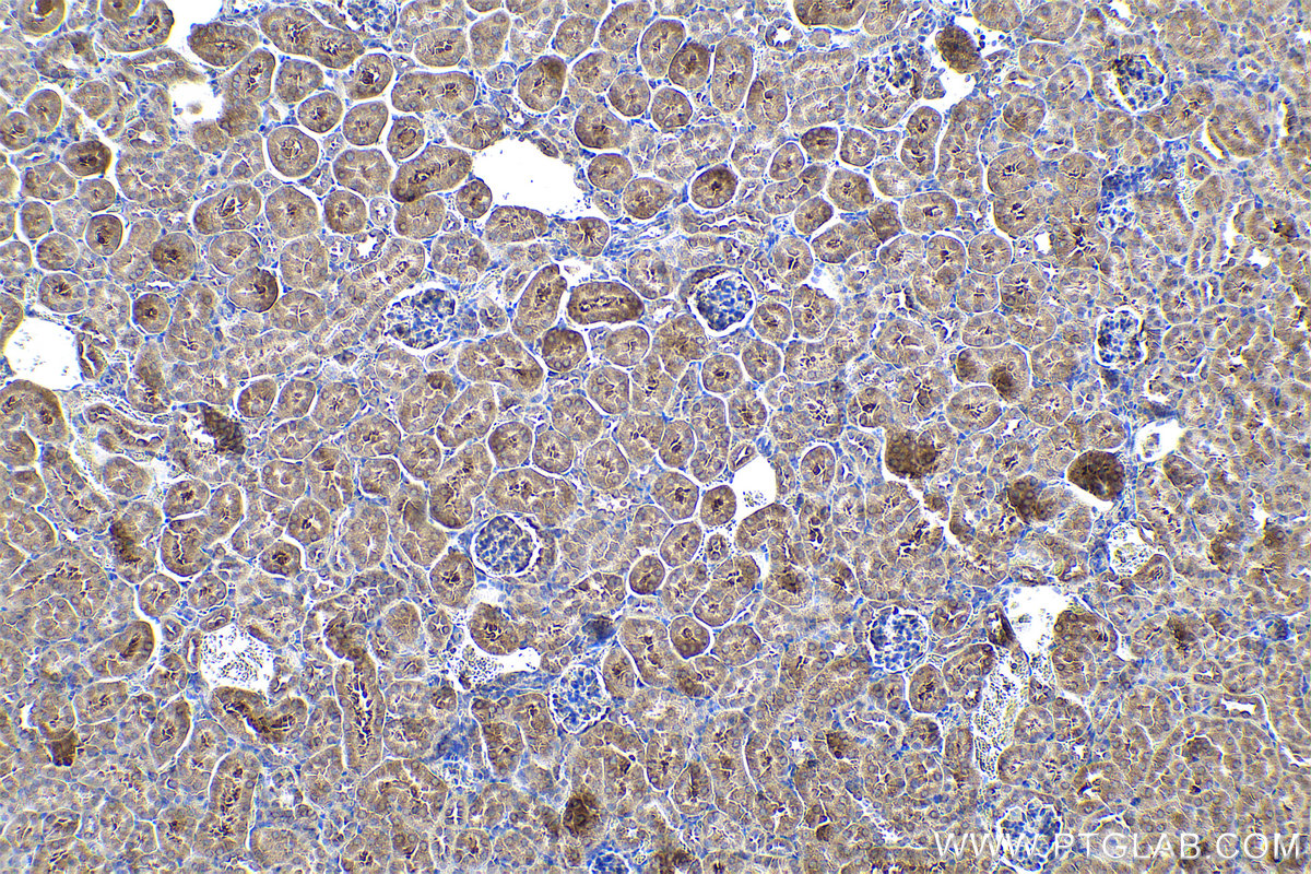 Immunohistochemical analysis of paraffin-embedded mouse kidney tissue slide using KHC0935 (G3BP2 IHC Kit).