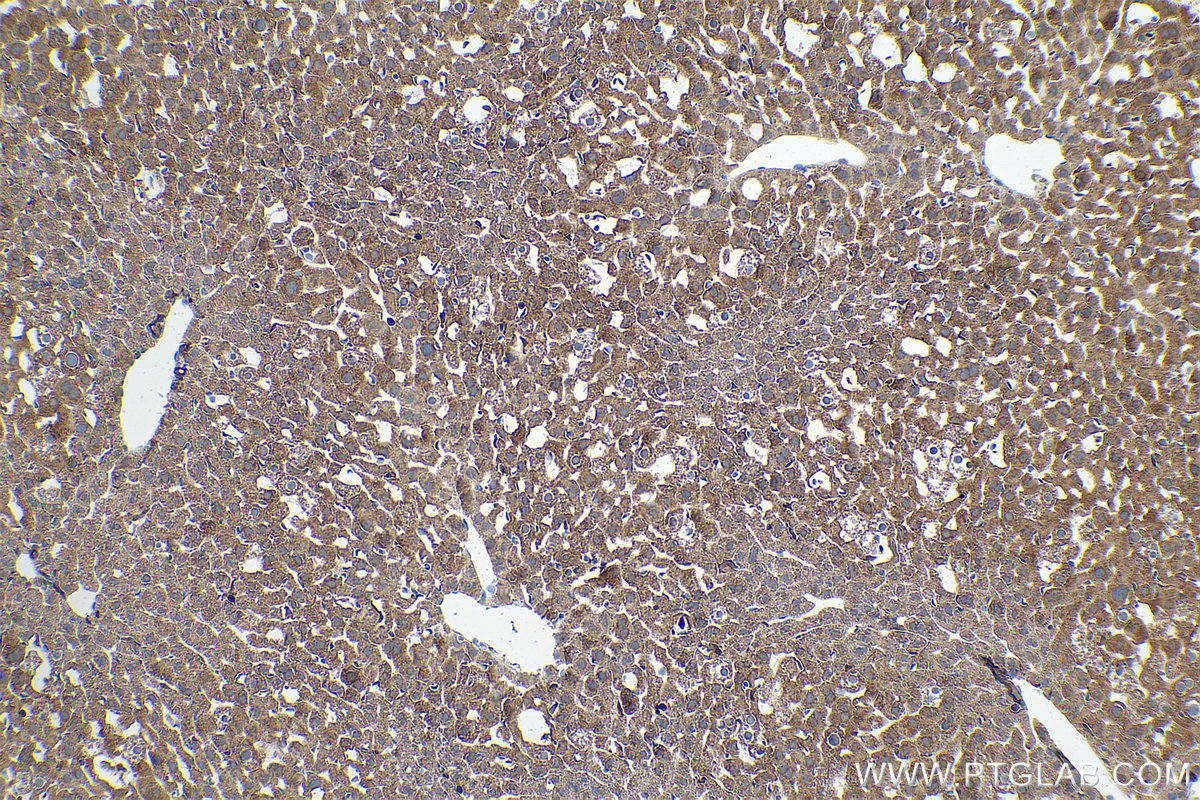 Immunohistochemical analysis of paraffin-embedded mouse liver tissue slide using KHC0876 (G6PD IHC Kit).