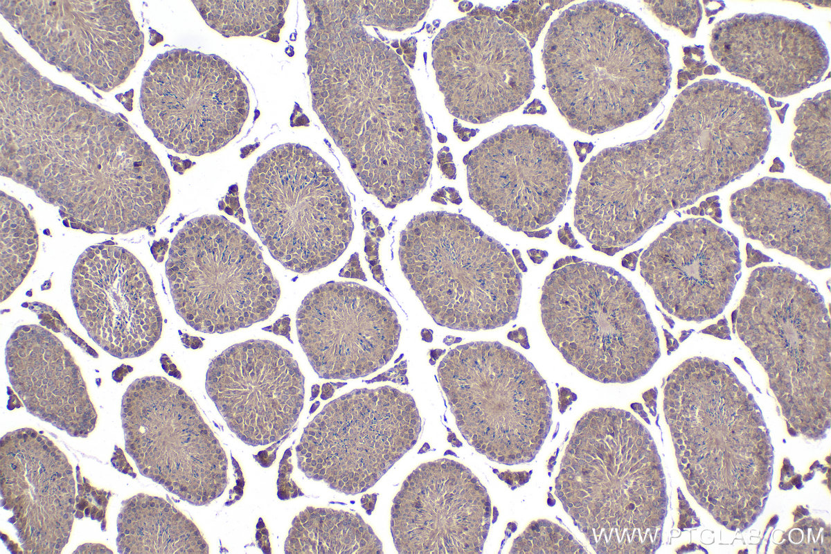 Immunohistochemical analysis of paraffin-embedded mouse testis tissue slide using KHC2065 (GAK IHC Kit).