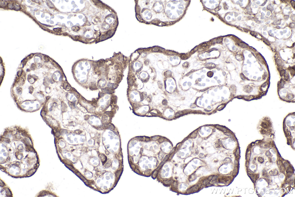 Immunohistochemical analysis of paraffin-embedded human placenta tissue slide using KHC2065 (GAK IHC Kit).