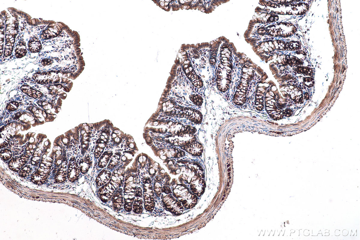 Immunohistochemical analysis of paraffin-embedded mouse colon tissue slide using KHC0896 (GALK1 IHC Kit).