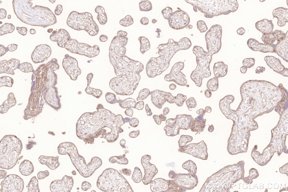 Immunohistochemical analysis of paraffin-embedded human placenta tissue slide using KHC3281 (GALNT10 IHC Kit).