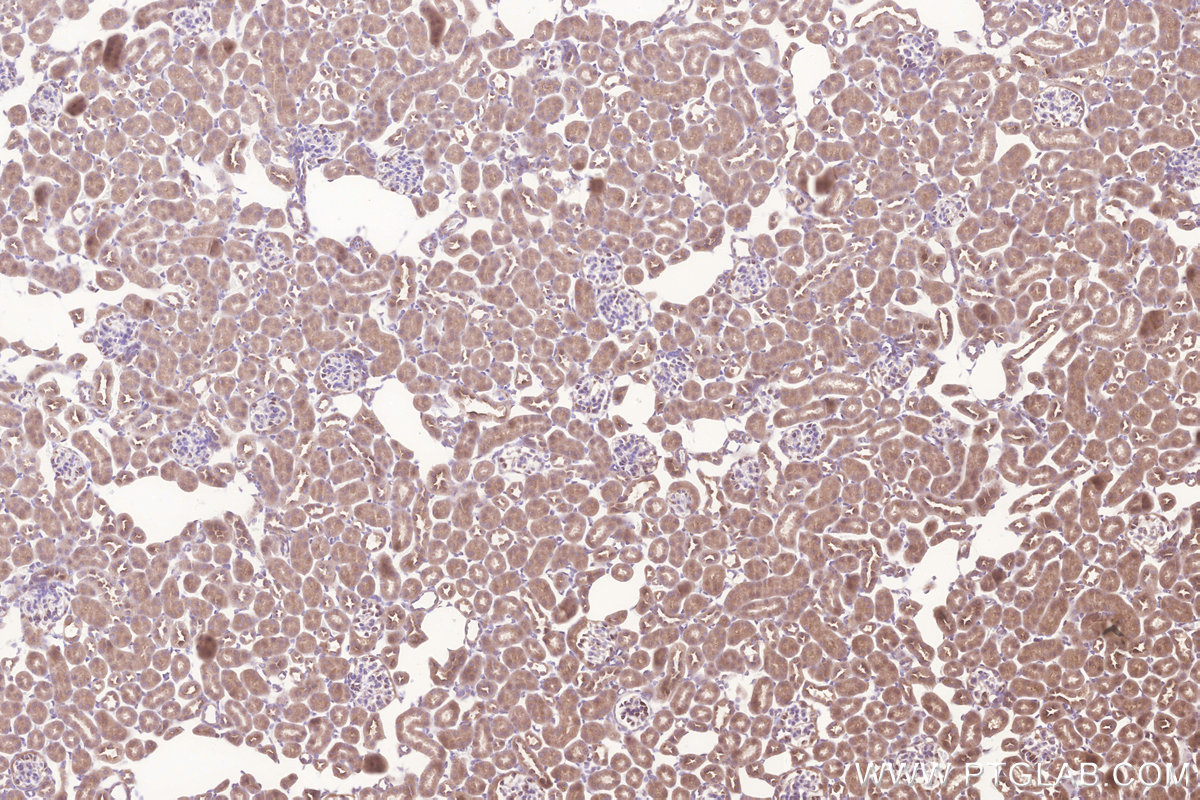 Immunohistochemical analysis of paraffin-embedded mouse kidney tissue slide using KHC3281 (GALNT10 IHC Kit).