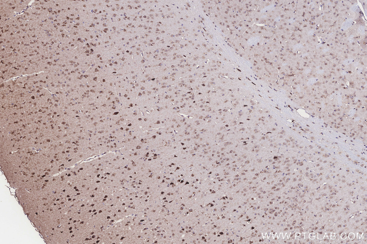 Immunohistochemical analysis of paraffin-embedded mouse brain tissue slide using KHC3270 (GALNT17/WBSCR17 IHC Kit).