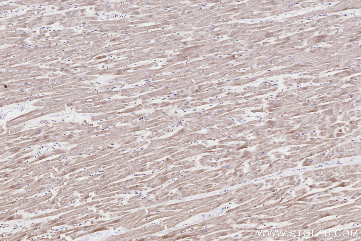 Immunohistochemical analysis of paraffin-embedded human heart tissue slide using KHC3270 (GALNT17/WBSCR17 IHC Kit).