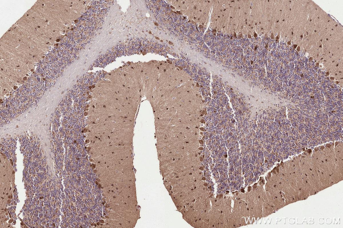 Immunohistochemical analysis of paraffin-embedded mouse cerebellum tissue slide using KHC3270 (GALNT17/WBSCR17 IHC Kit).