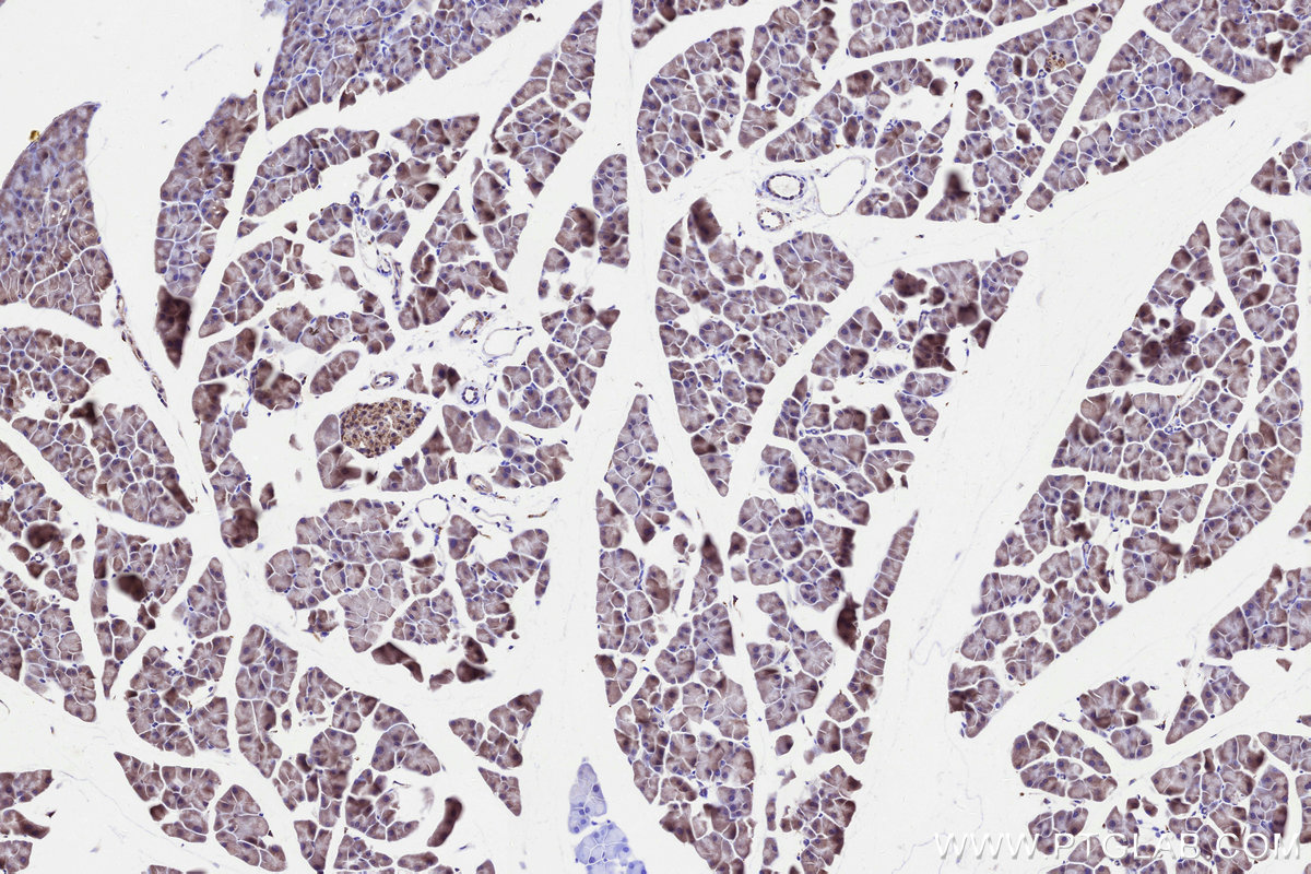 Immunohistochemical analysis of paraffin-embedded mouse pancreas tissue slide using KHC3288 (GALNT4 IHC Kit).