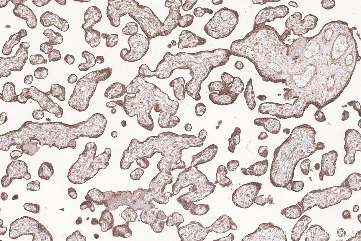 Immunohistochemical analysis of paraffin-embedded human placenta tissue slide using KHC3295 (GALNT6 IHC Kit).