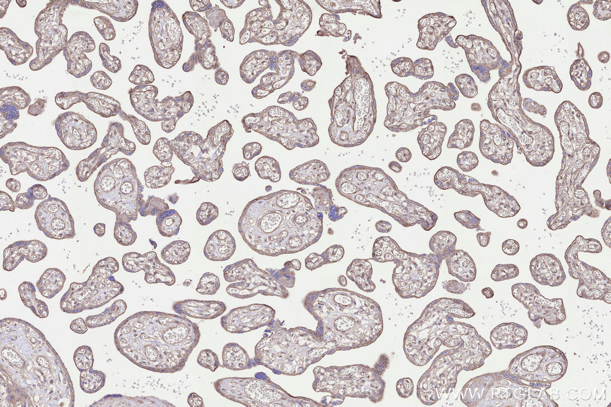 Immunohistochemical analysis of paraffin-embedded human placenta tissue slide using KHC3287 (GALNTL2 IHC Kit).