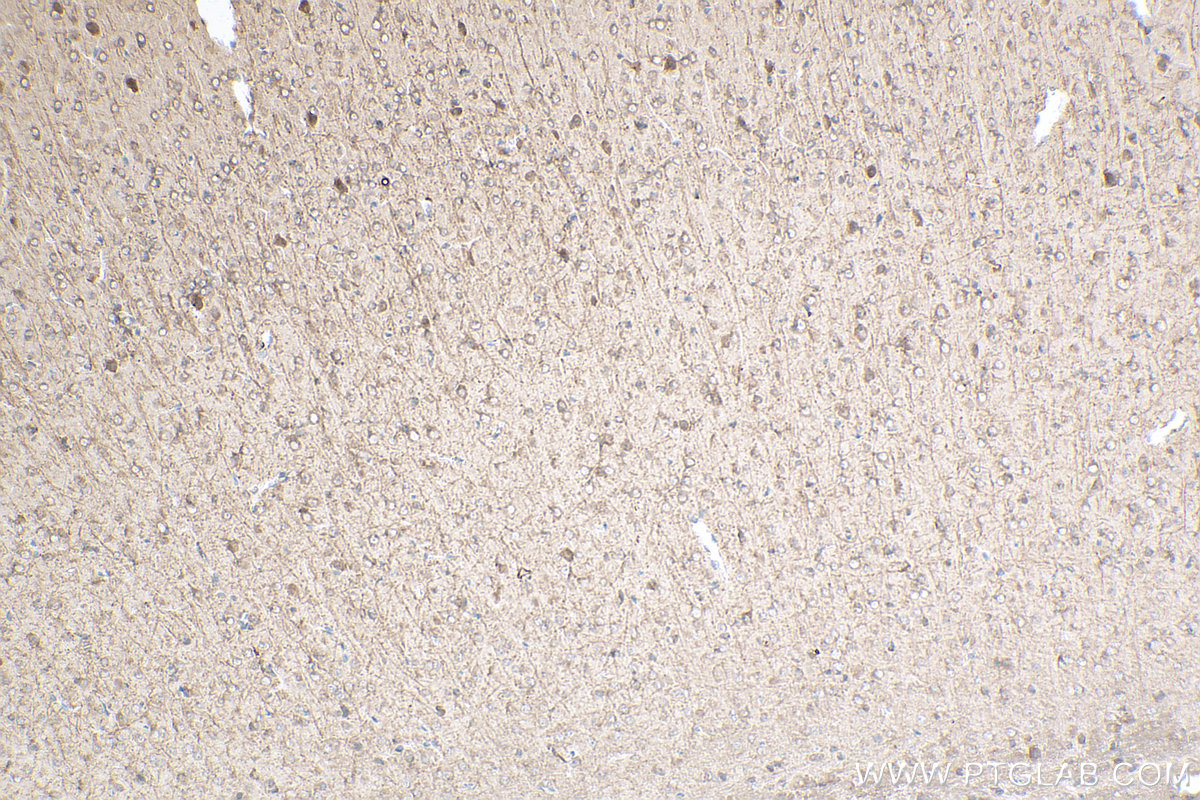 Immunohistochemical analysis of paraffin-embedded mouse brain tissue slide using KHC0810 (GALR2 IHC Kit).