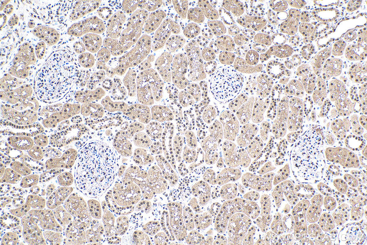 Immunohistochemical analysis of paraffin-embedded human kidney tissue slide using KHC0501 (GAPDH IHC Kit).