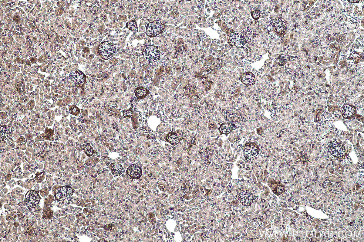 Immunohistochemical analysis of paraffin-embedded mouse kidney tissue slide using KHC0501 (GAPDH IHC Kit).