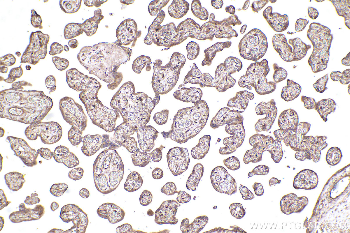 Immunohistochemical analysis of paraffin-embedded human placenta tissue slide using KHC2472 (GAPVD1 IHC Kit).