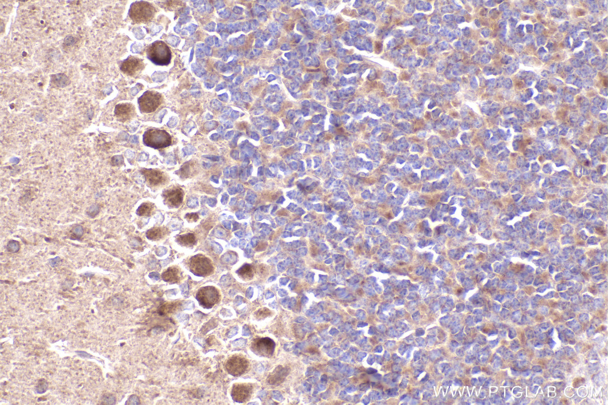 Immunohistochemical analysis of paraffin-embedded mouse cerebellum tissue slide using KHC2472 (GAPVD1 IHC Kit).