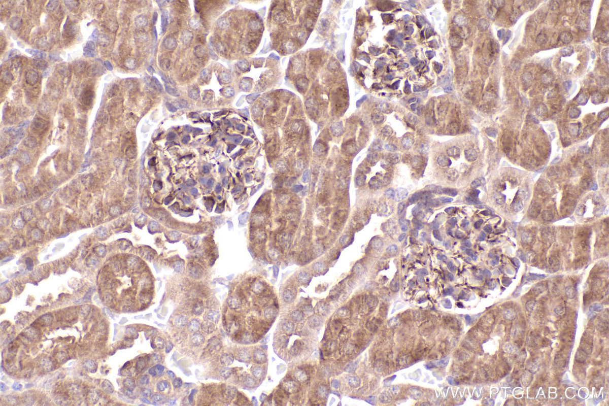 Immunohistochemical analysis of paraffin-embedded mouse kidney tissue slide using KHC2472 (GAPVD1 IHC Kit).