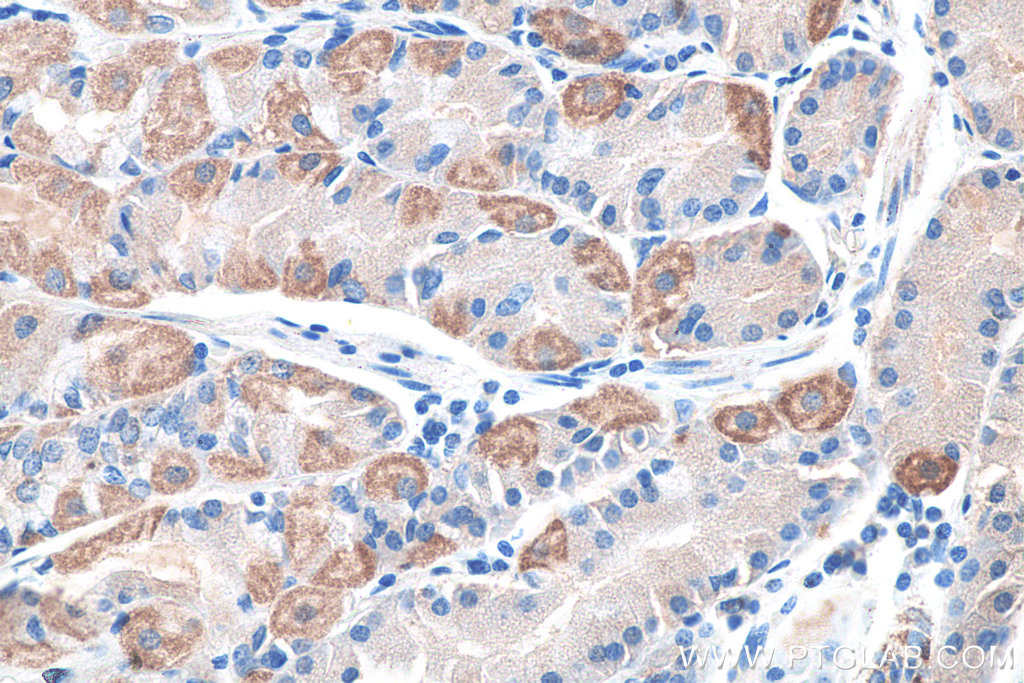 Immunohistochemical analysis of paraffin-embedded human stomach tissue slide using KHC0282 (GAST IHC Kit).