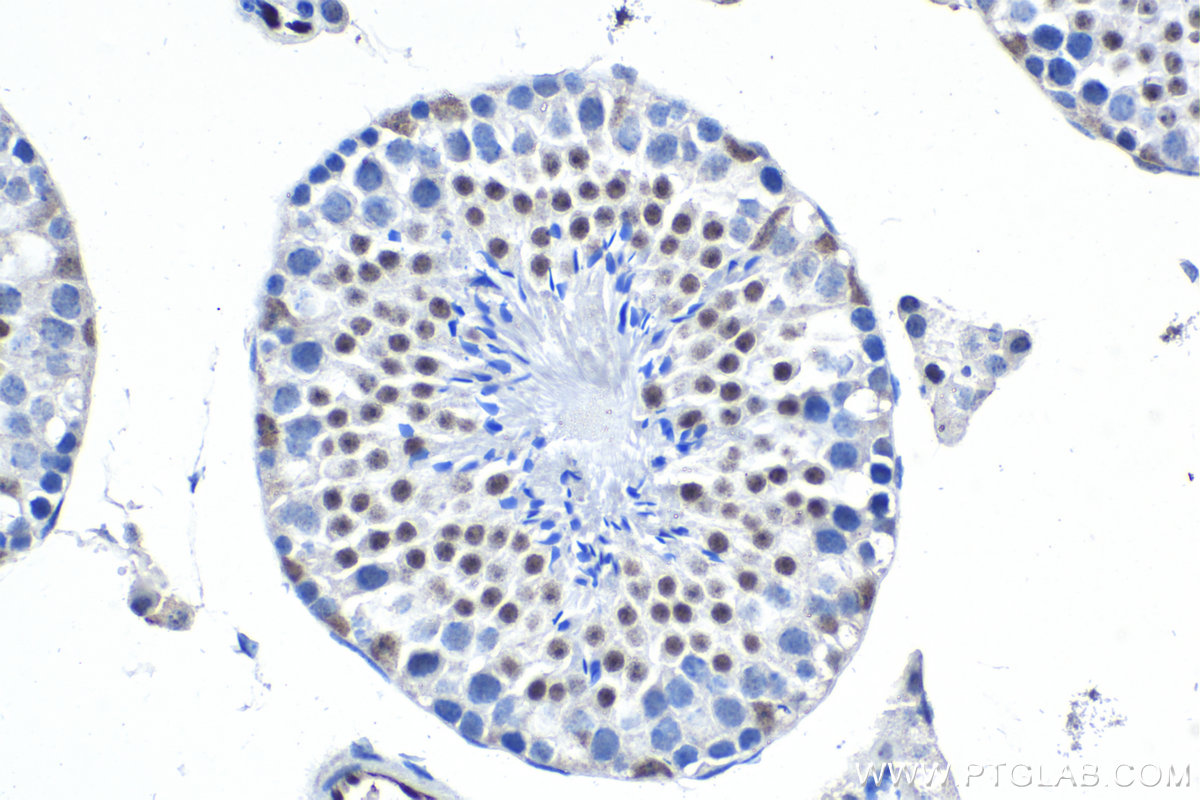 Immunohistochemical analysis of paraffin-embedded mouse testis tissue slide using KHC1601 (GATA2 IHC Kit).