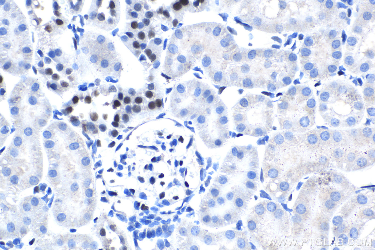 Immunohistochemical analysis of paraffin-embedded rat kidney tissue slide using KHC1601 (GATA2 IHC Kit).