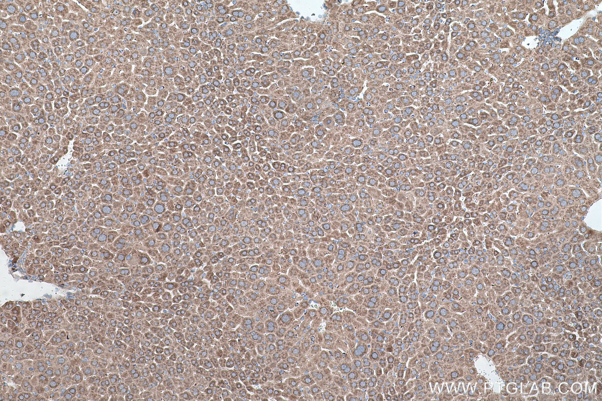 Immunohistochemical analysis of paraffin-embedded mouse liver tissue slide using KHC0560 (GATM IHC Kit).