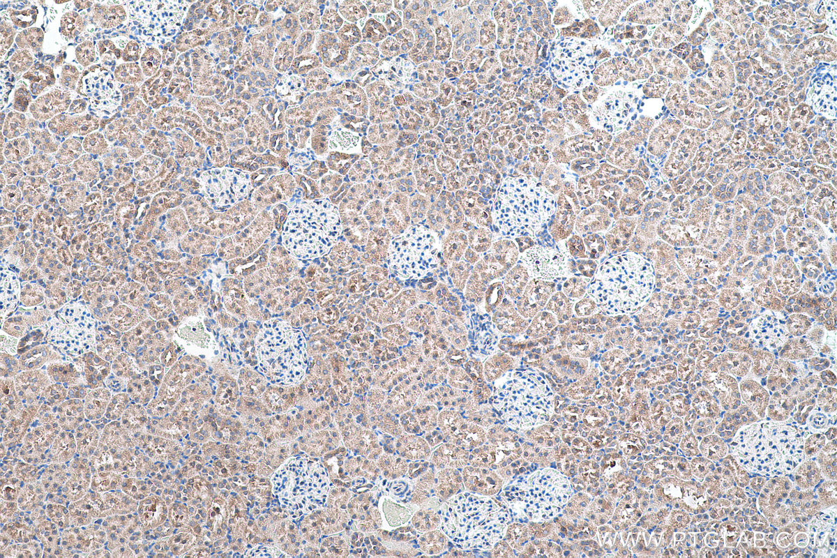 Immunohistochemical analysis of paraffin-embedded rat kidney tissue slide using KHC0560 (GATM IHC Kit).