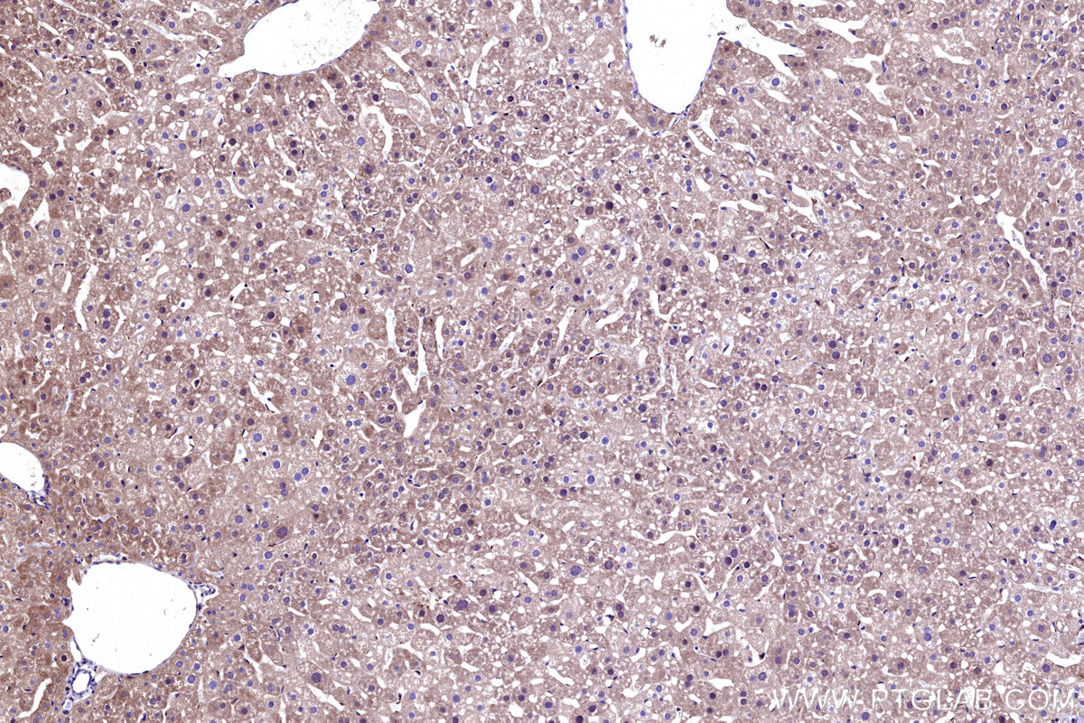 Immunohistochemical analysis of paraffin-embedded mouse liver tissue slide using KHC3166 (GBA IHC Kit).