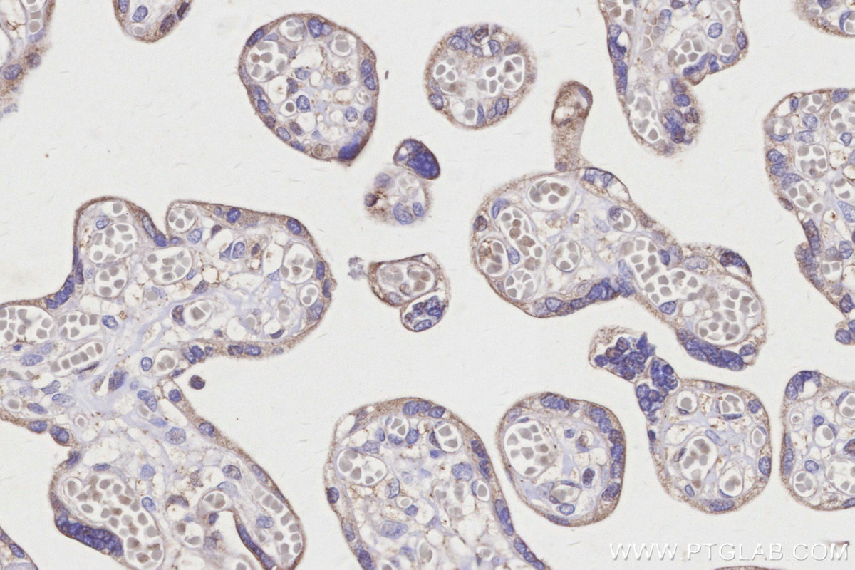 Immunohistochemical analysis of paraffin-embedded human placenta tissue slide using KHC3166 (GBA IHC Kit).