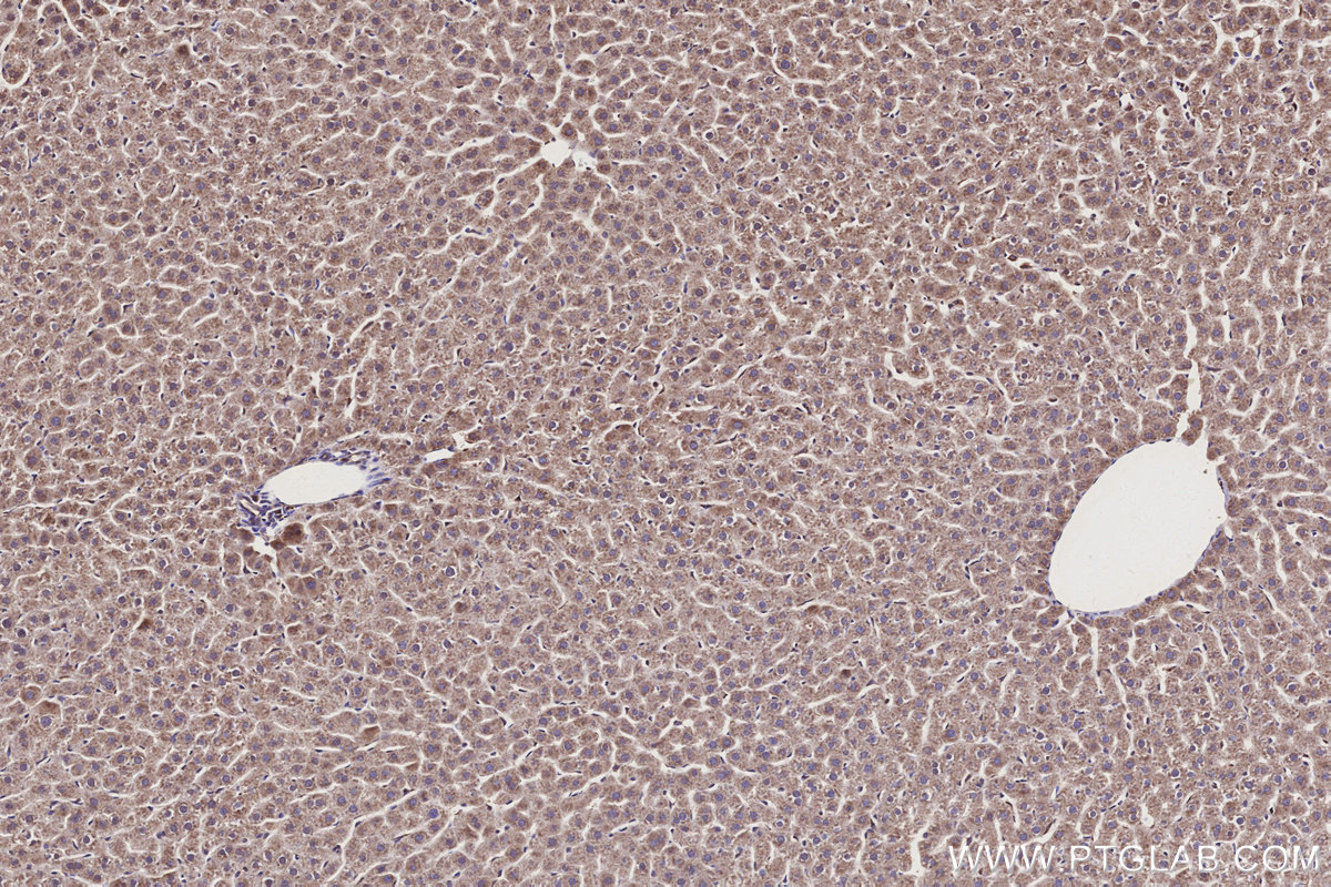Immunohistochemical analysis of paraffin-embedded rat liver tissue slide using KHC3166 (GBA IHC Kit).