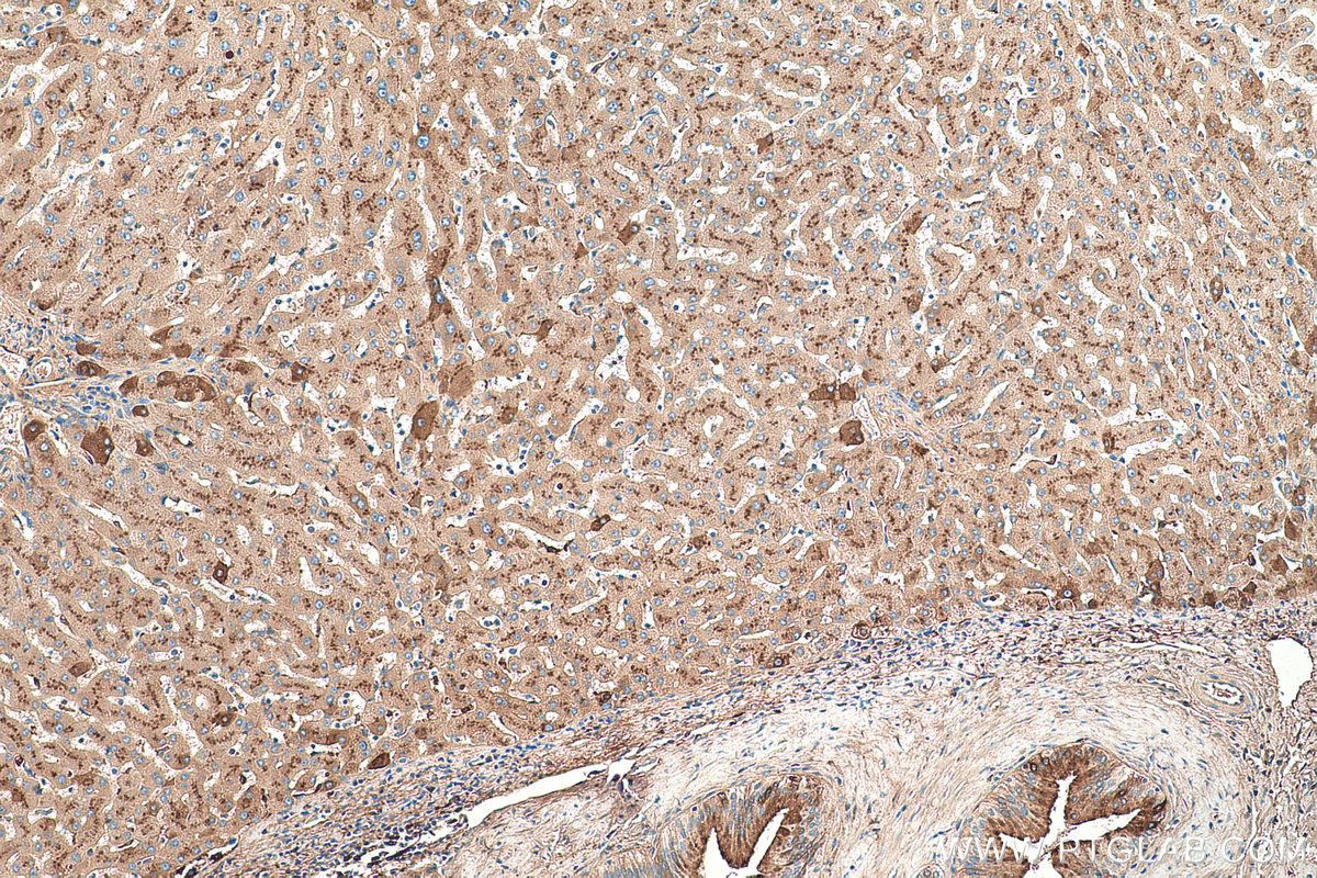 Immunohistochemical analysis of paraffin-embedded human liver tissue slide using KHC0422 (GC/VTDB IHC Kit).