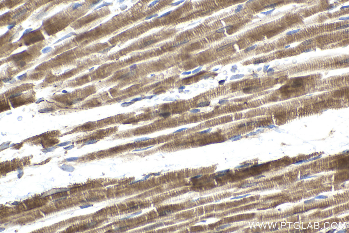 Immunohistochemical analysis of paraffin-embedded rat heart tissue slide using KHC1584 (GCK IHC Kit).