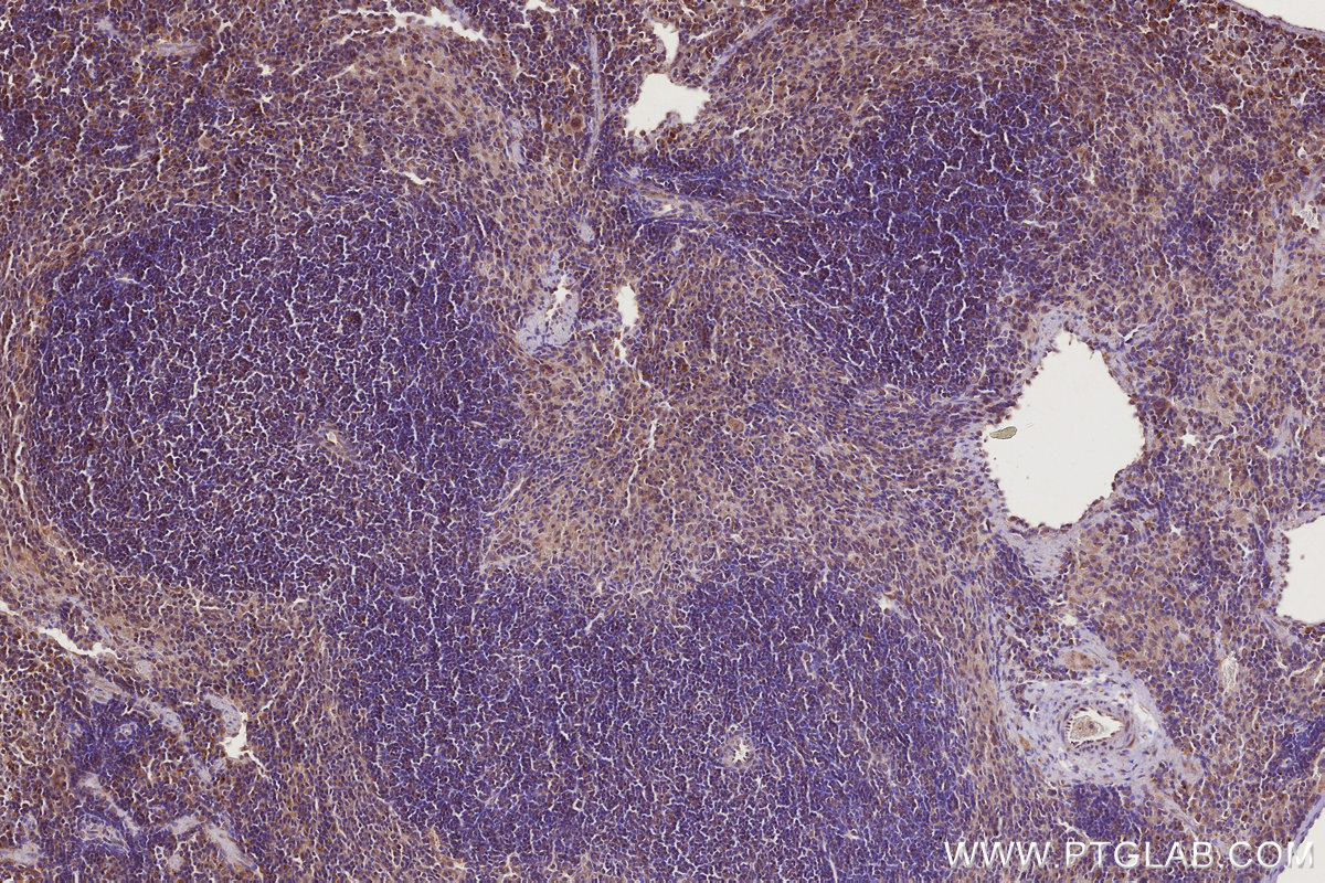 Immunohistochemical analysis of paraffin-embedded mouse spleen tissue slide using KHC2769 (GEF-H1 IHC Kit).