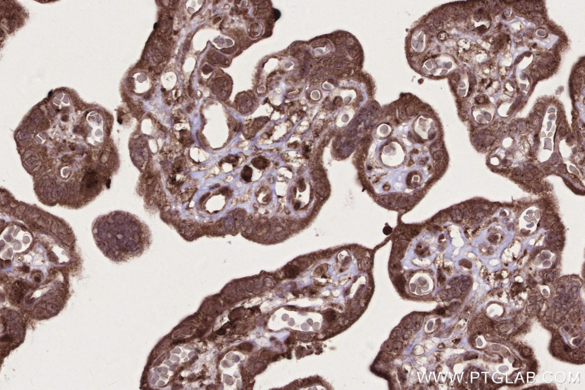 Immunohistochemical analysis of paraffin-embedded human placenta tissue slide using KHC2725 (GEMIN5 IHC Kit).