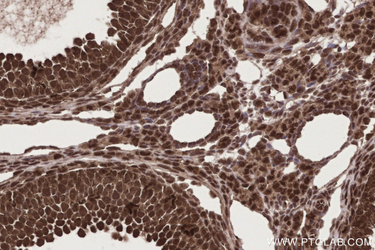 Immunohistochemical analysis of paraffin-embedded mouse ovary tissue slide using KHC2725 (GEMIN5 IHC Kit).
