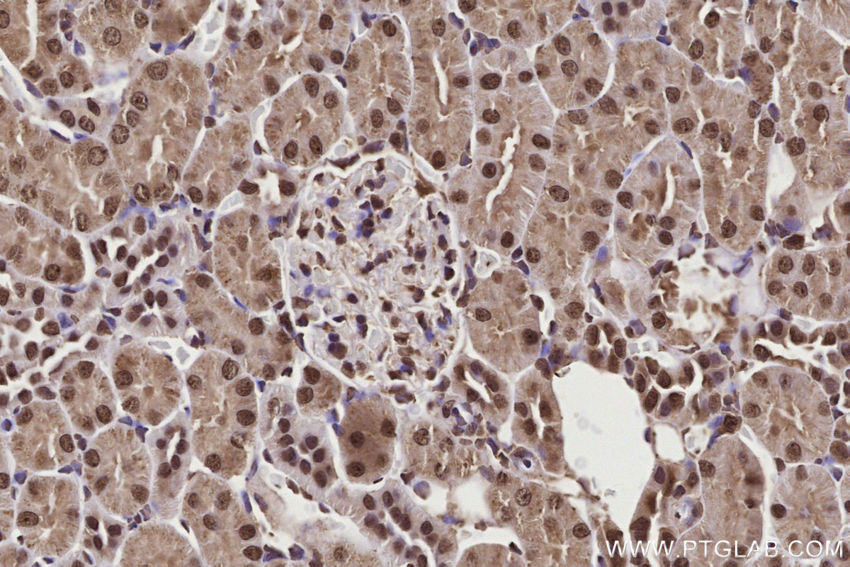 Immunohistochemical analysis of paraffin-embedded rat kidney tissue slide using KHC2725 (GEMIN5 IHC Kit).