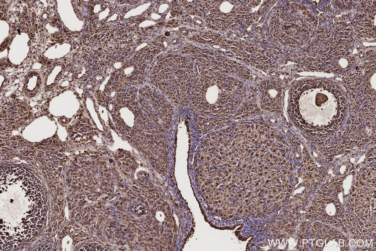 Immunohistochemical analysis of paraffin-embedded rat ovary tissue slide using KHC2725 (GEMIN5 IHC Kit).