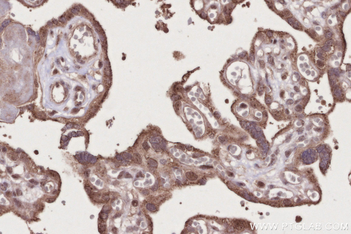 Immunohistochemical analysis of paraffin-embedded human placenta tissue slide using KHC2739 (GEMIN6 IHC Kit).