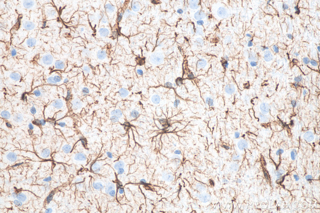 Immunohistochemical analysis of paraffin-embedded rat brain tissue slide using KHC0002 (GFAP IHC Kit).