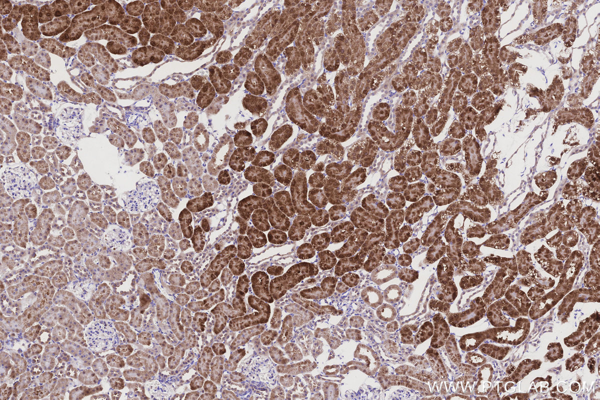 Immunohistochemical analysis of paraffin-embedded rat kidney tissue slide using KHC3200 (GLDC IHC Kit). Immunohistochemical analysis of paraffin-embedded rat kidney tissue slide using KHC3200 (GLDC IHC Kit).