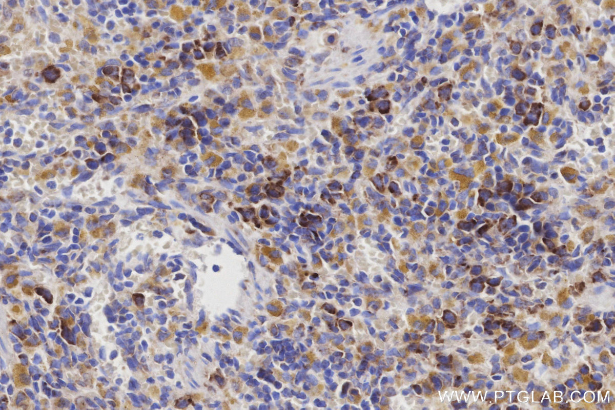 Immunohistochemical analysis of paraffin-embedded rat spleen tissue slide using KHC3200 (GLDC IHC Kit). Immunohistochemical analysis of paraffin-embedded rat spleen tissue slide using KHC3200 (GLDC IHC Kit).