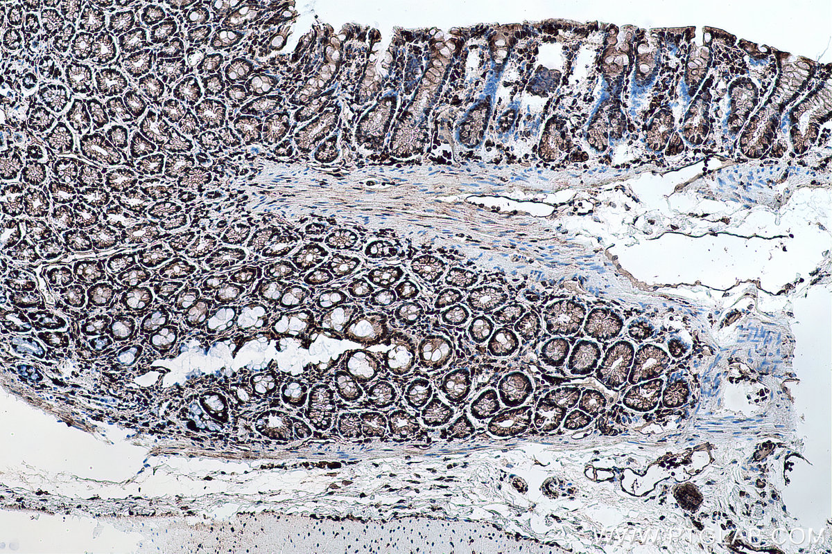 Immunohistochemical analysis of paraffin-embedded rat colon tissue slide using KHC0136 (GLI2-Specific IHC Kit).