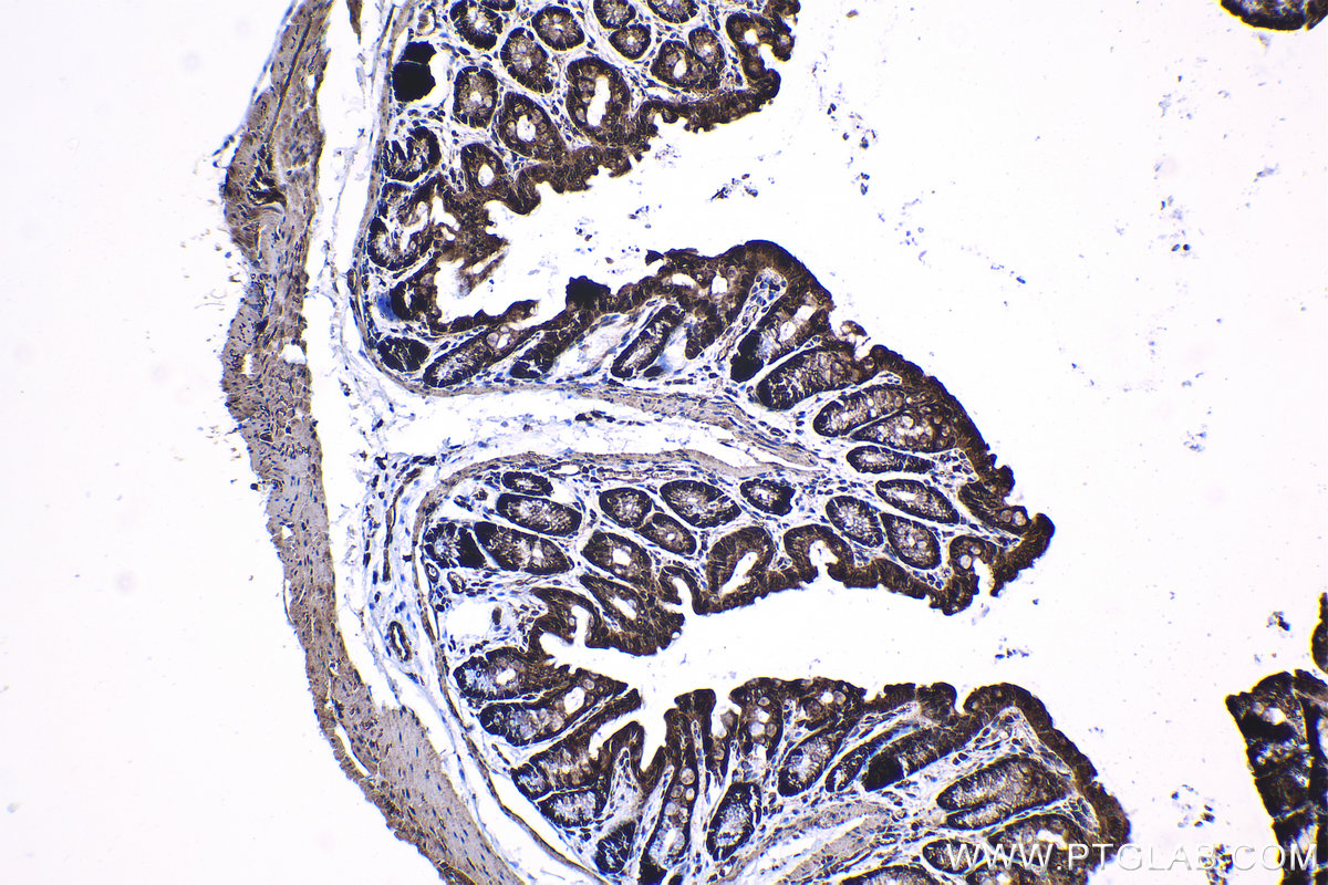 Immunohistochemical analysis of paraffin-embedded mouse colon tissue slide using KHC1379 (GLI2 IHC Kit).